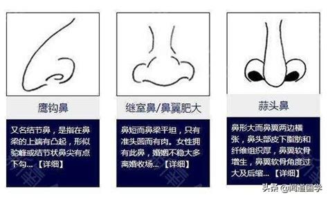 鼻孔三角形 面相|15种鼻型，你属于哪一种？